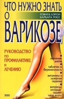 Что нужно знать о варикозе Руководство по профилактике и лечению артикул 6202a.