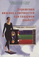 Поражения нижних конечностей при сахарном диабете артикул 6265a.